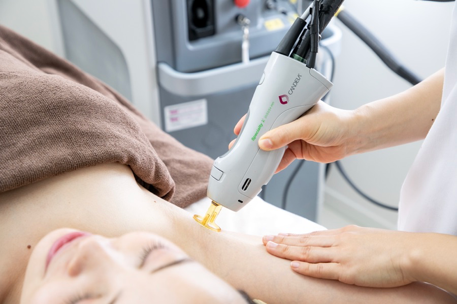 脱毛を受けている女性